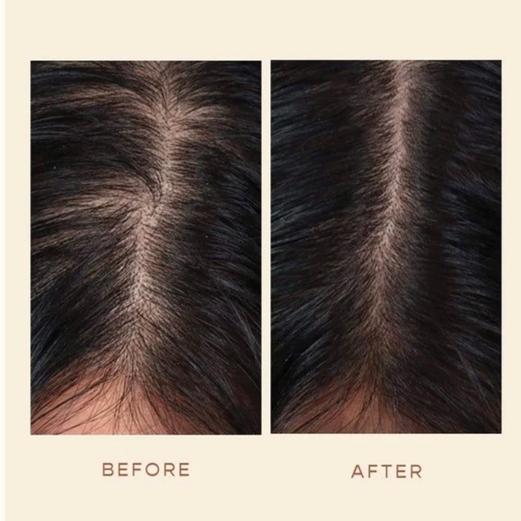 Vegamour GRO Hair Serum - Picture 3 of 9